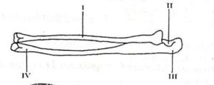 Part of a skeleton.jpg